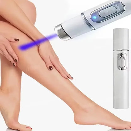 Laser Therapy For Varicose Vein Treatment Effective Relieve Legs Dilated Vasculitis Phlebitis Improve Circulation Blue Light Pen